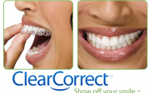 ClearCorrect with retainer Dental Care Center