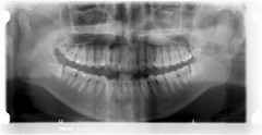 teeth xray Dental Care Center