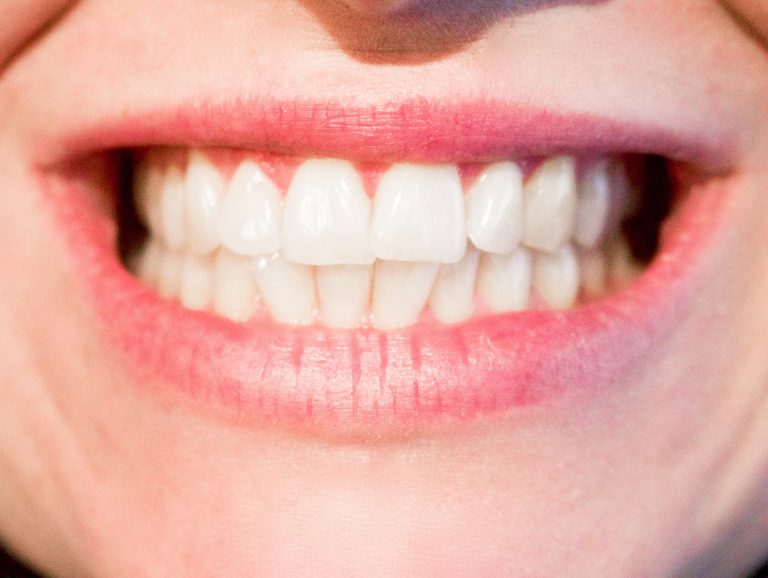 teeth smiling Dental Care Center